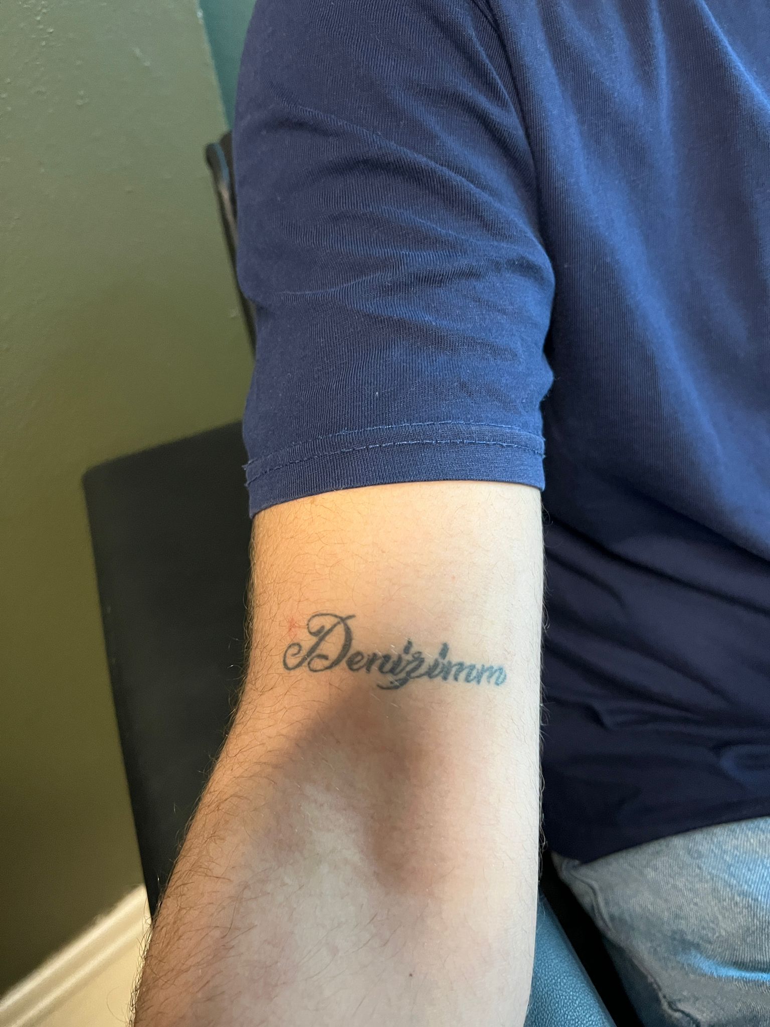 Dövme Sildirme Önce 1