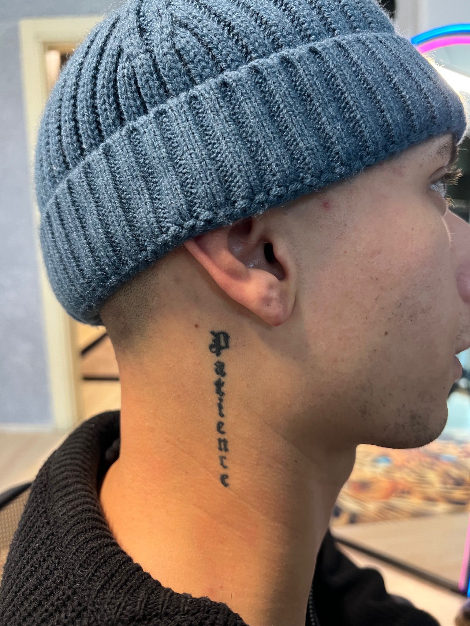 Dövme Sildirme Önce 4